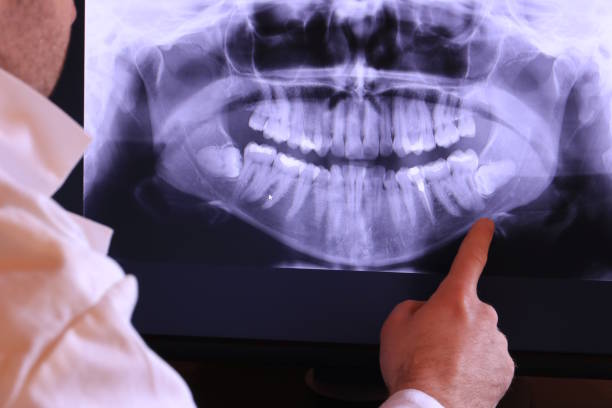 Best Emergency Tooth Extraction in Nicholls, GA