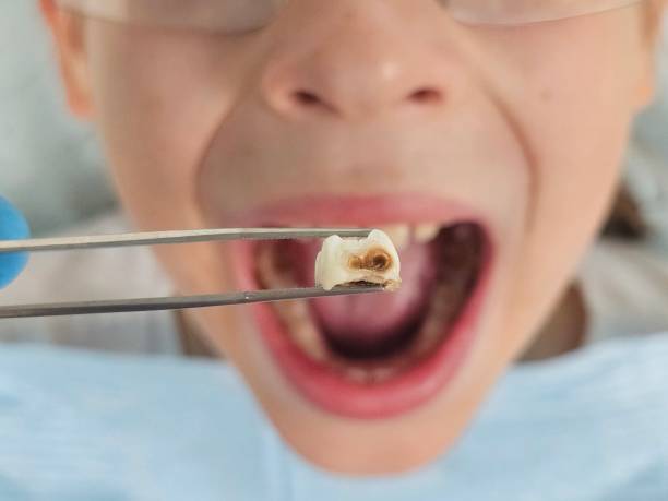 Best After-Hours Emergency Dentist in Nicholls, GA
