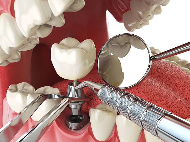 Best Weekend Emergency Dentist in Nicholls, GA